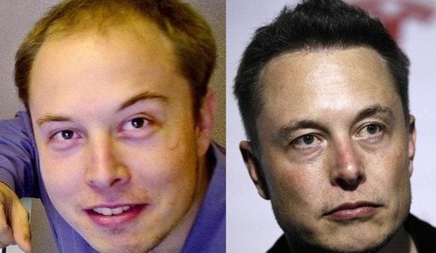 Elon Musk Before and After